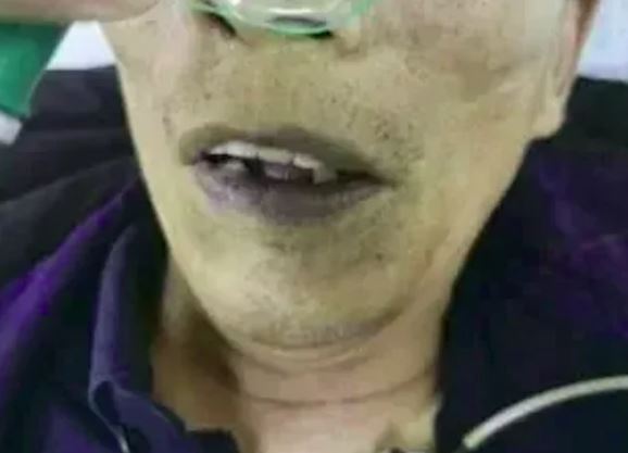 Sau khi ăn món khoái khẩu, người đàn ông 73 tuổi đột ngột ngã quỵ, toàn thân chuyển màu xanh- Ảnh 1.