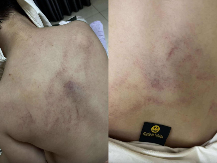 Bé gái 4 tuổi bị cô giáo bạo hành ở Hà Nội: Hành động gây sốc từ giáo viên - Ảnh 1.